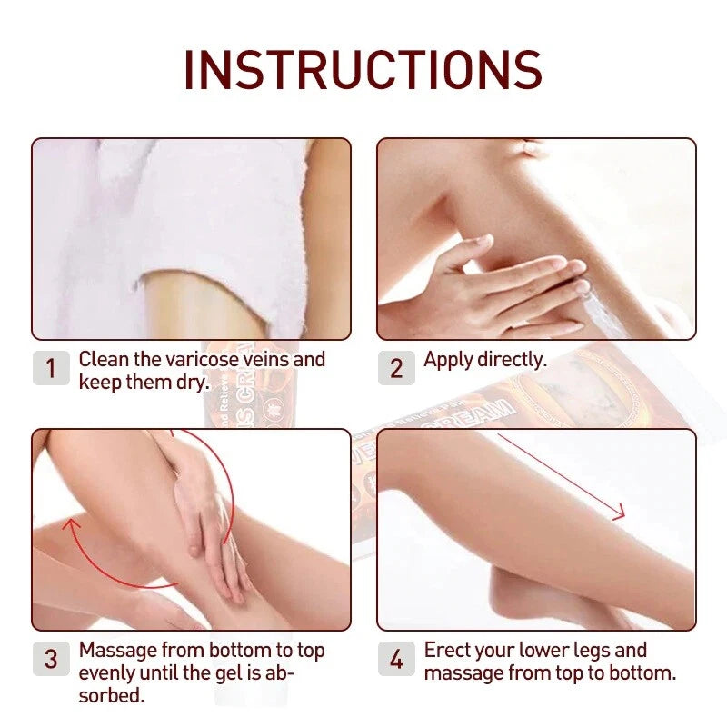 100%Original Vasculitis Blood Circulation Varicose Veins Treatment New Cream 20g
