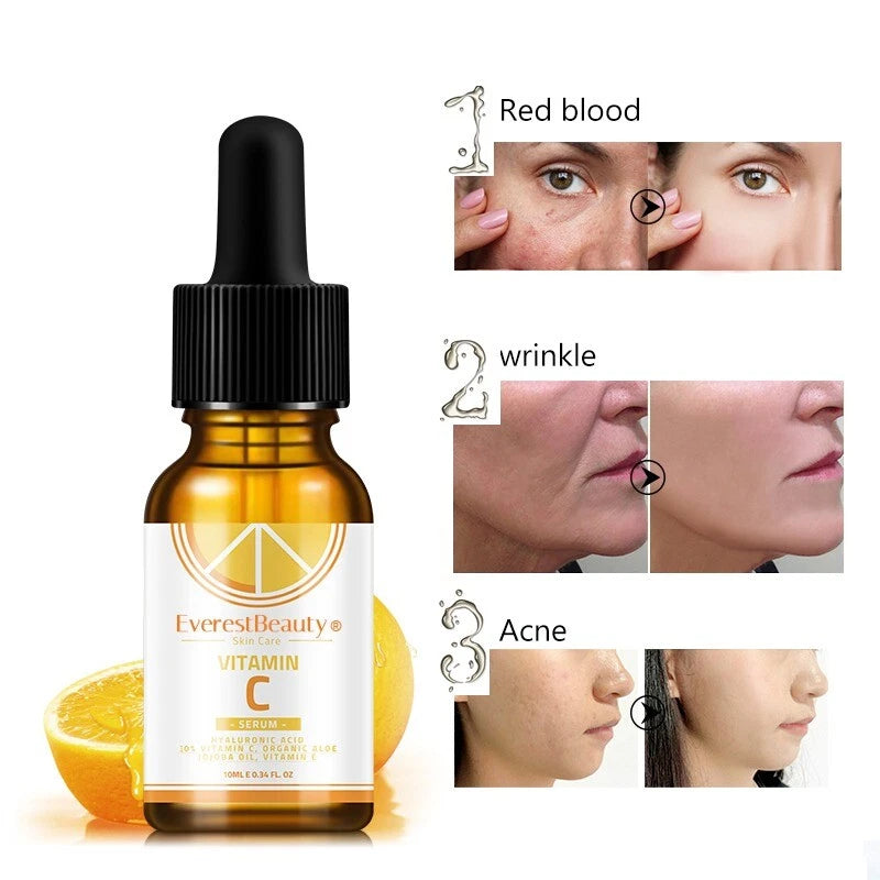 3xVitamin C serum with Hyaluronic Acid Suitable for Anti Ageing/Wrinkle Face