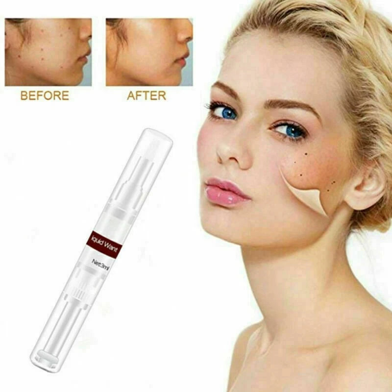 WipeOff™ Skin Tags & Moles Warts Corn Remover - Restore Skin Health and Beauty