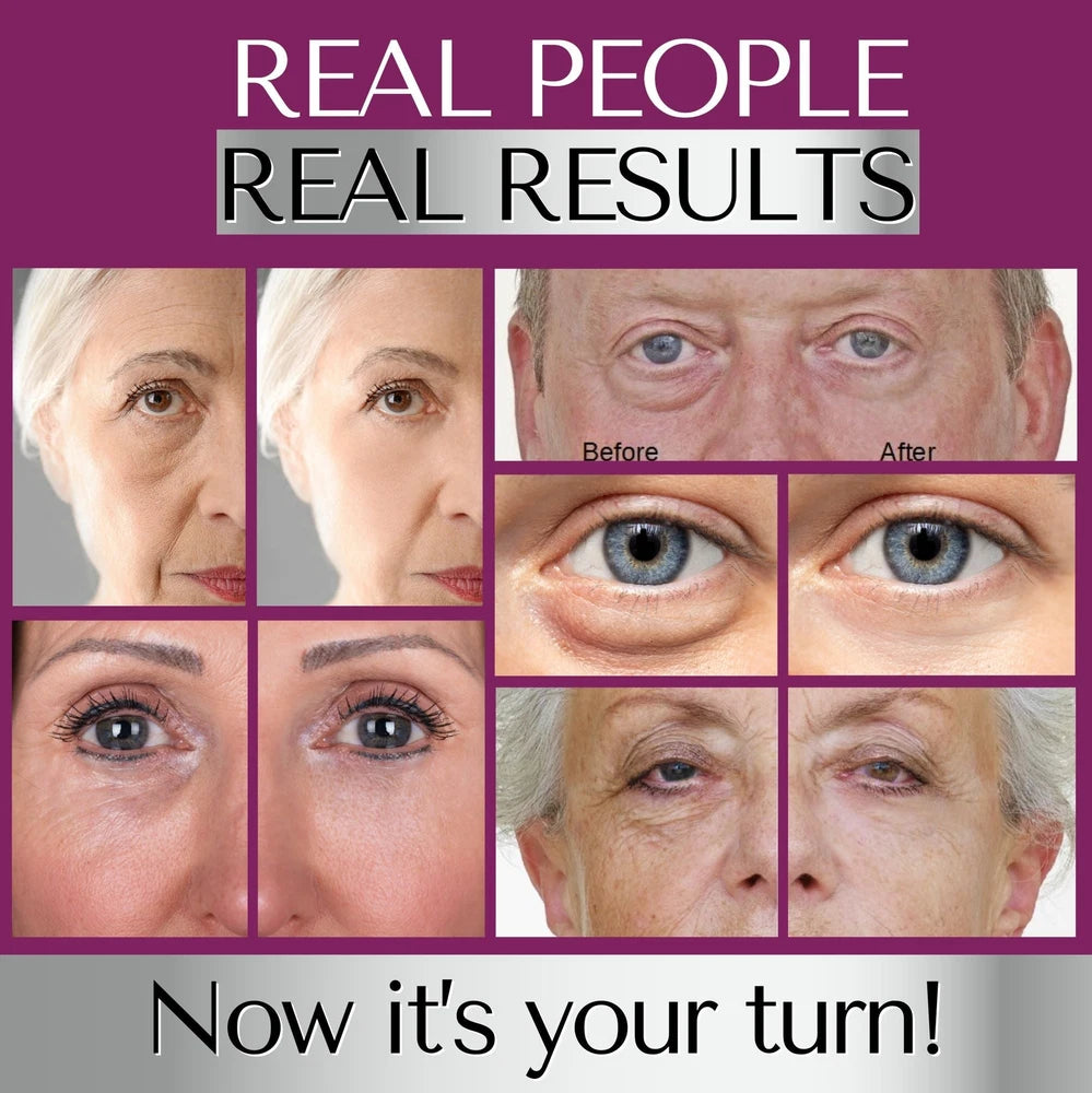 INSTANT WRINKLE Eye Tightener Cream Wrinkle Remover Serum with Argireline