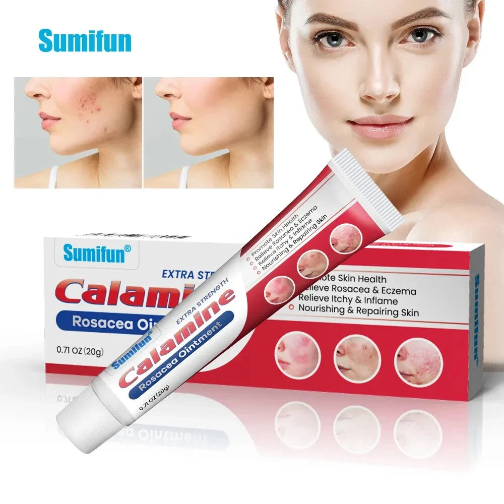 20g New Rosacea Ointment Treat Red Nose Acne Cream Pimple Scar Repair Skin Care