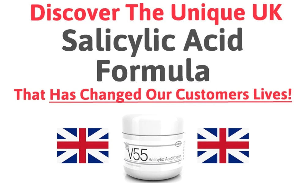 V55 Salicylic Acid Cream Spot Treatment Blackheads Blemishes Problem Skin Spots