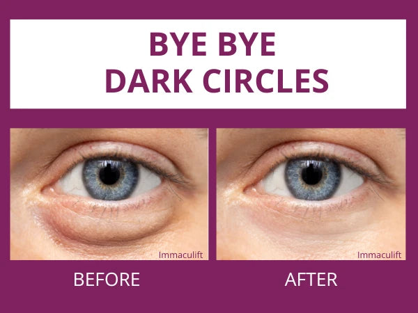 INSTANT WRINKLE Eye Tightener Cream Wrinkle Remover Serum with Argireline