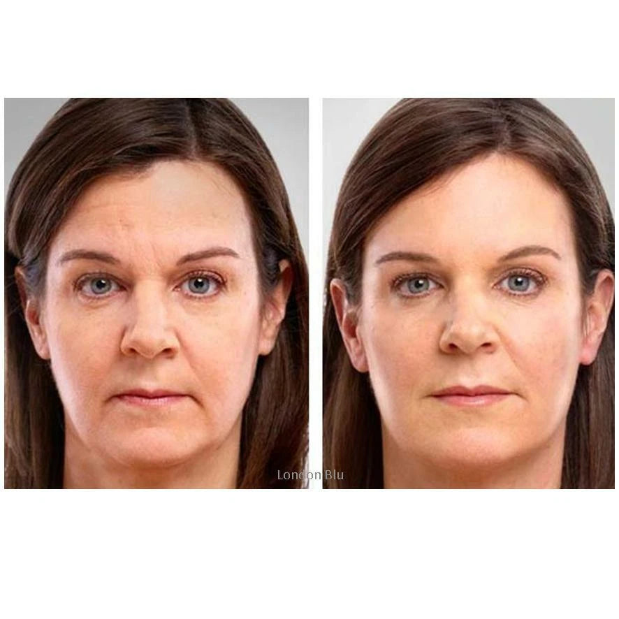 INSTANT FACE LIFT ANTI WRINKLE CREAM FINE LINE SERUM WORKS INSTANTLY ⭐️⭐️⭐️⭐️⭐️