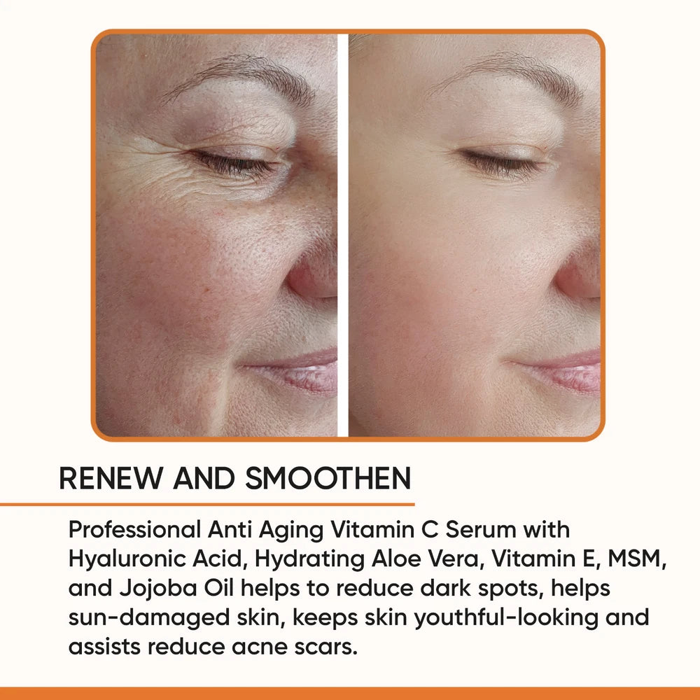 100% PURE VITAMIN C SERUM FOR FACE, Anti Aging Serum with Hyaluronic Acid (2 OZ)