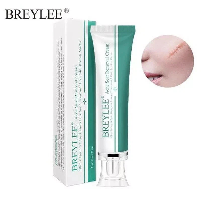 Breylee Acne Scar Removal Cream 30G Face Cream Skin Repair Skin Care Scar Acne