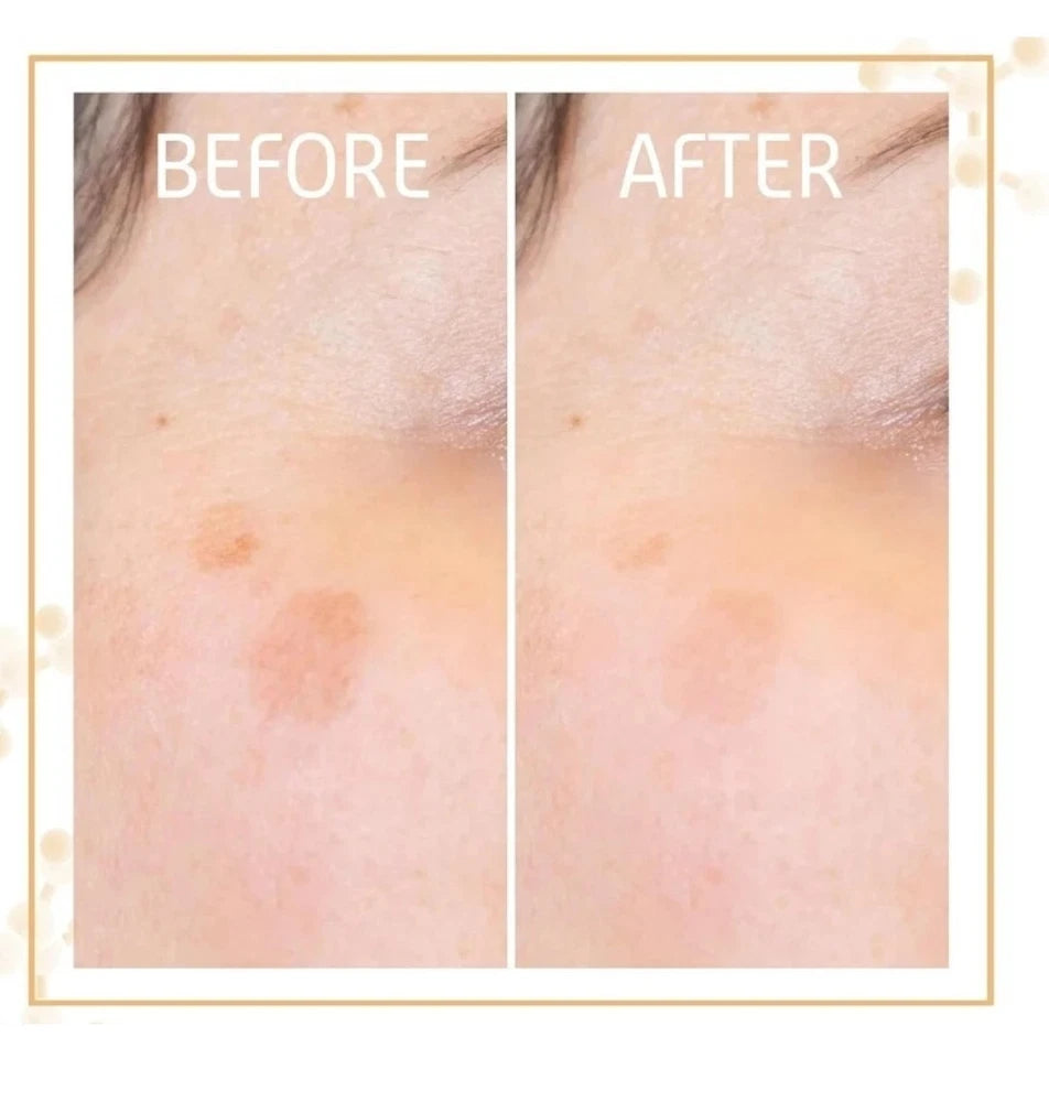 Vitamin C Firming Face Serum 30Ml - 57% More Collagen Production 25% Reduction A