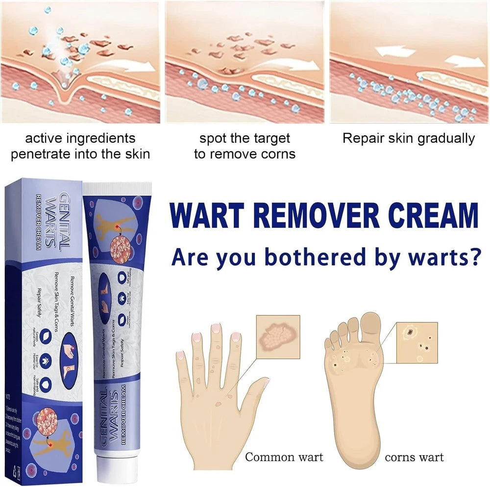 Skin Tag Mole Wart Remover Removal Cream Ointment Fast Safe Natural Treatment