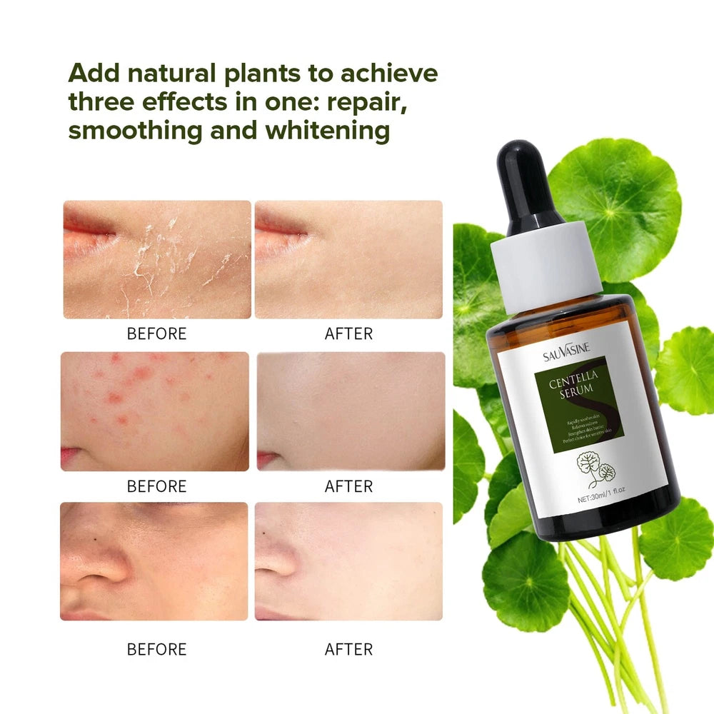 Centella Serum for Fade Spots, even skin tone & Sensinol Control Soothing 30ml