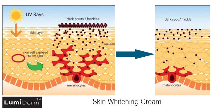 FACE WHITENING LIGHTENING CREAM SKIN LIGHTENER WHITENER BRIGHTER FRECKLE MELASMA