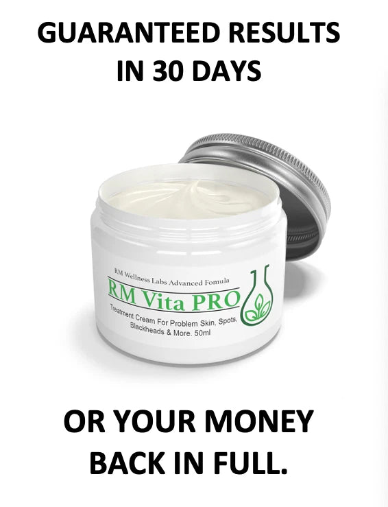 Fast Acting Spots & Acne Treatment Cream Cleanse Blackhead Facial Problem Skin