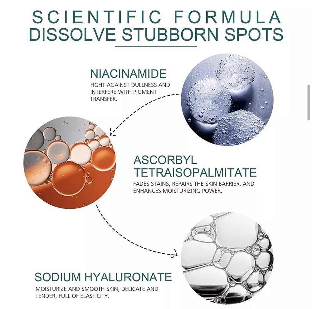 Whitening Freckle Cream Remove Dark Spots Anti-Freckle Cream Niacinamide Fade UK