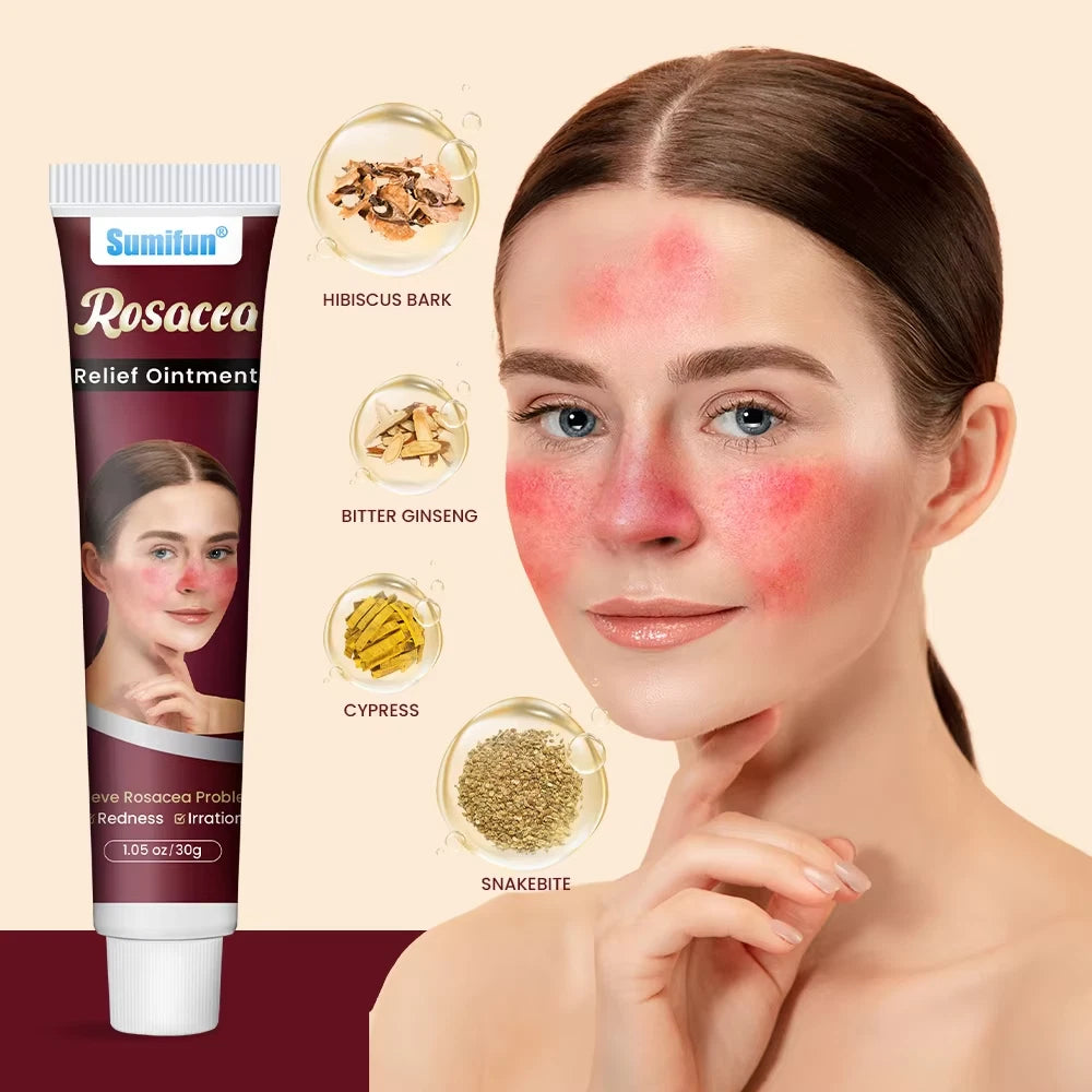 New 30g Natural Herbal Red Face Skin Care Rosacca Cream Red Skin Relief Ointment
