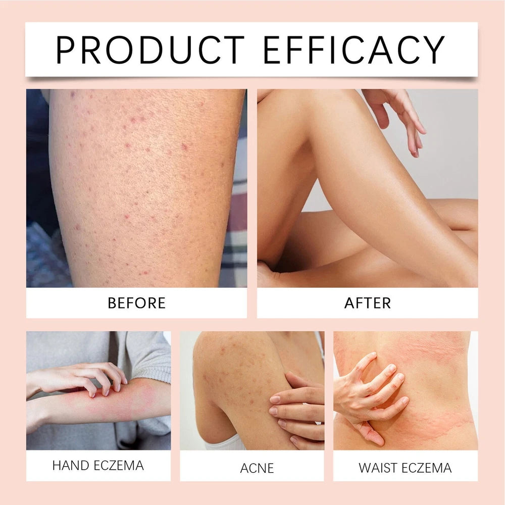 Beef Tallow For Face, Tallow Face Moisturizer 120g Organic Whipped Grass Fed