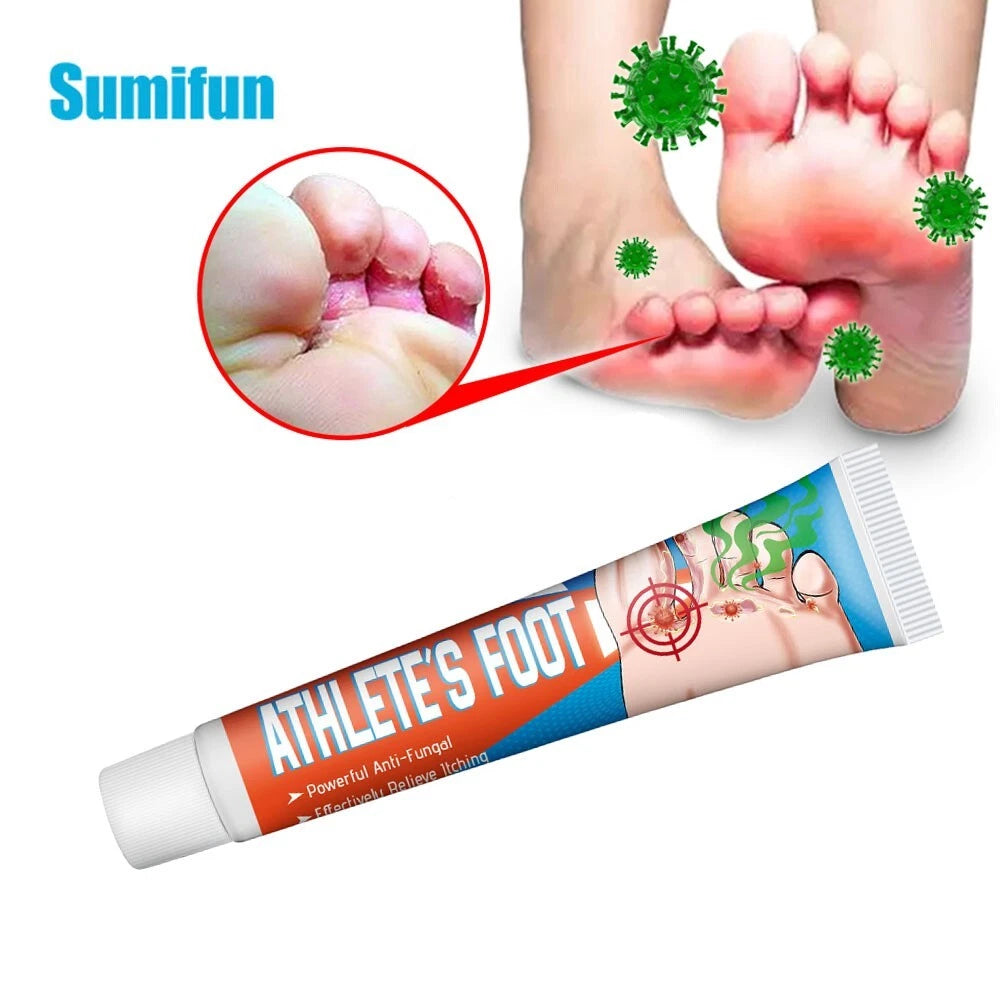 Beriberi Treat Athlete's Feet Ointment Foot Itching Anti-Fungal Peeling Tinea