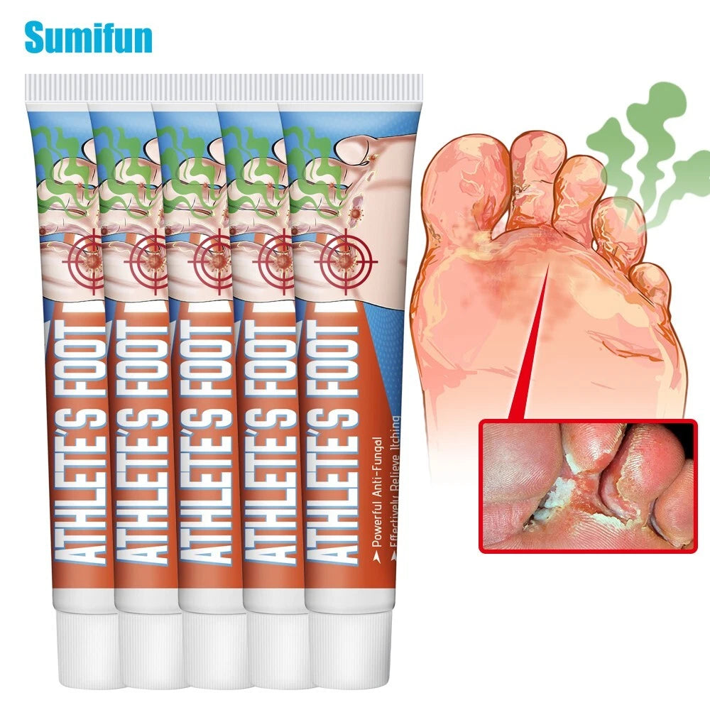 Beriberi Treat Athlete's Feet Ointment Foot Itching Anti-Fungal Peeling Tinea