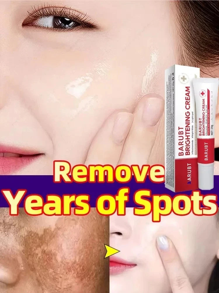 Melasma Treatment Dark Spots Cream Niacinamide Face Skin Brightening UK Seller