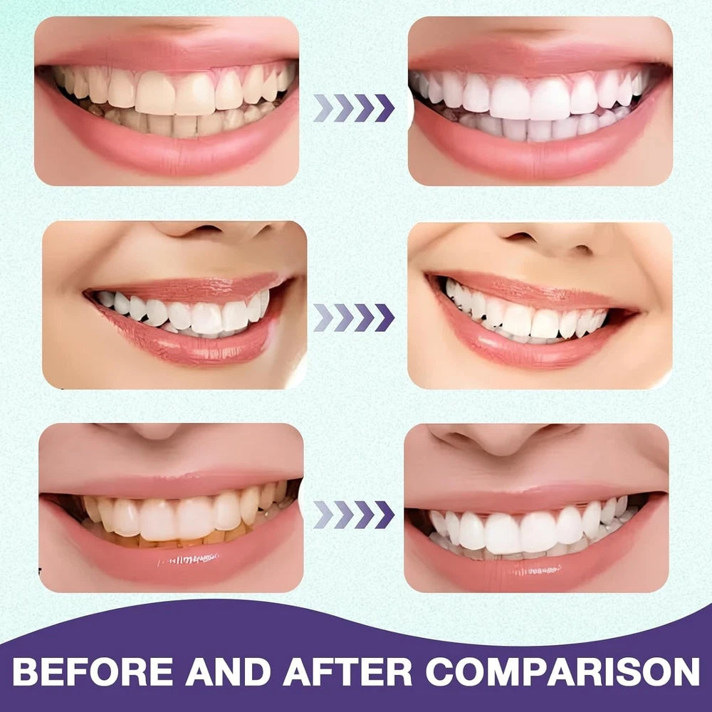 3 Pcs Gum Repair Gel, Mullein Gum Repair Gel, Mullend Gum Repair Cleaning Stain