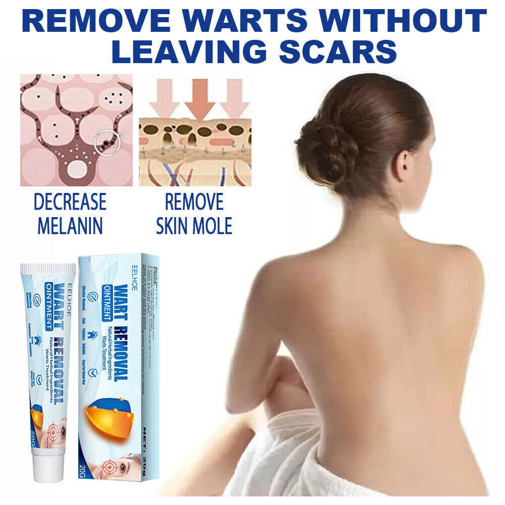Skin Tag Removal Warts Remover Cream Herbal Ointment Face Body Tag Remover 20g