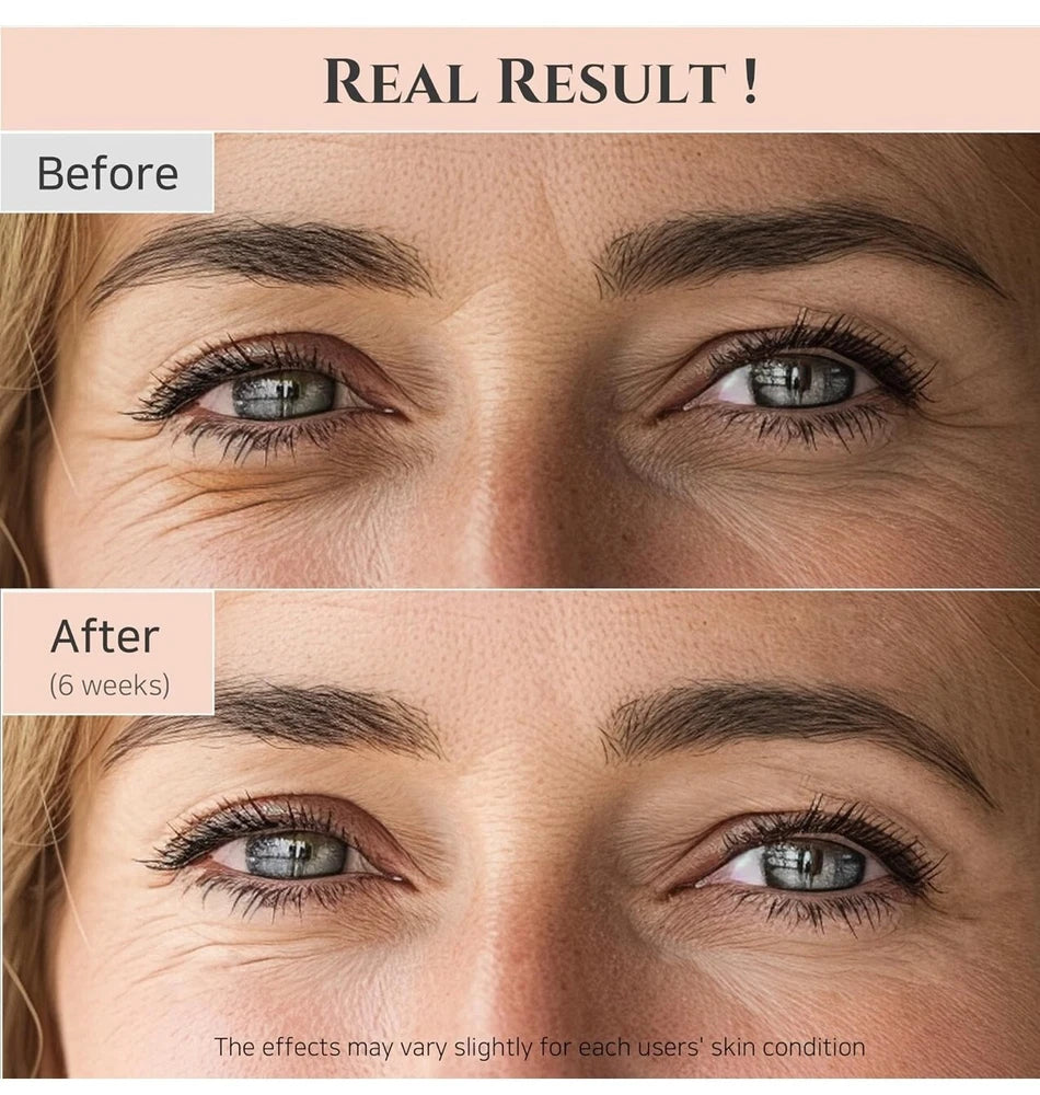 Beauty of Joseon Revive eye serum : Ginseng + Retinal, 30ml, 1fl.oz.