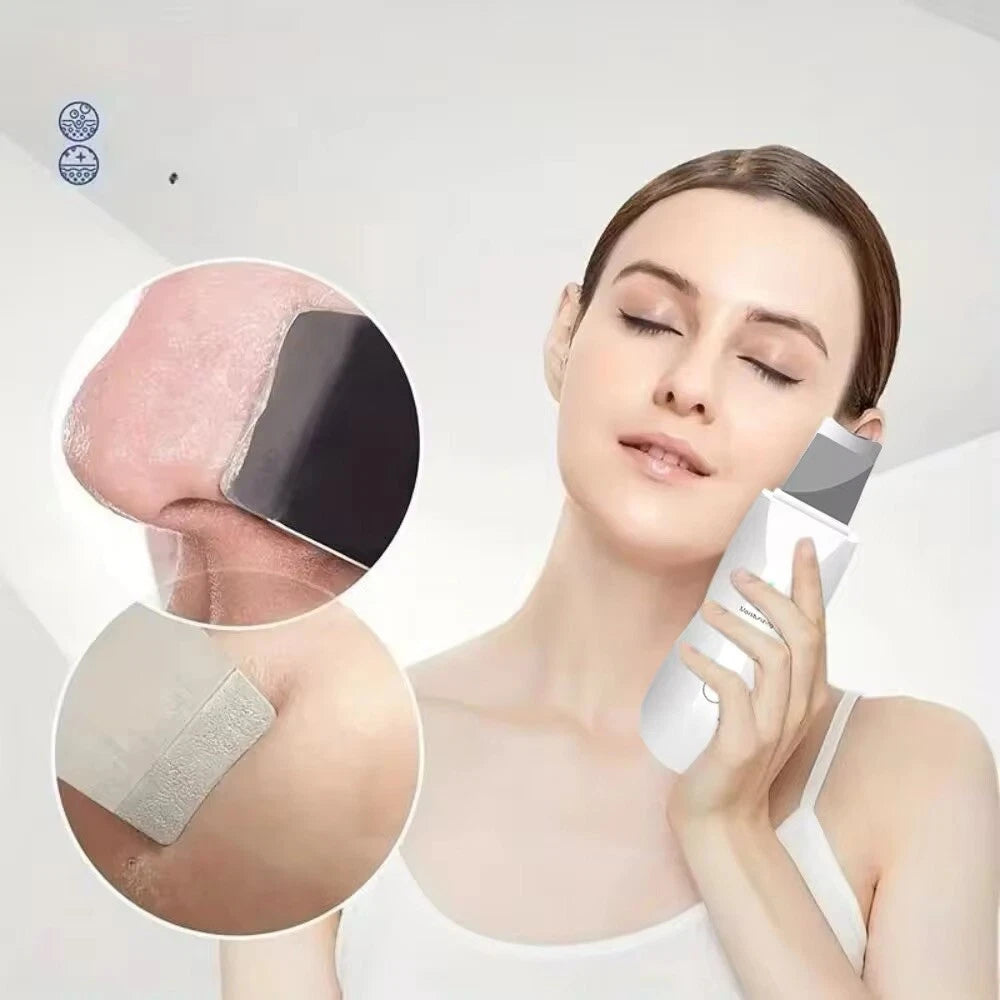 Facial Skin Scrubber, Ultrasonic Skin Spatula Face Blackhead Remover Machine🇬🇧