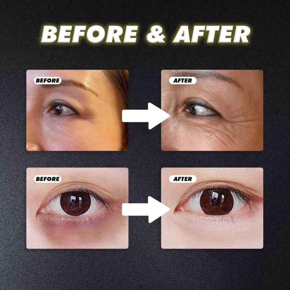 Turmeric Retinol Eye Cream Stick Anti-Ageing Dark Circles Puffiness Wrinkle Care