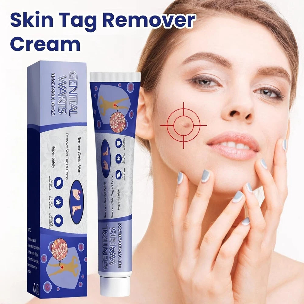 Skin Tag Mole Wart Remover Removal Cream Ointment Fast Safe Natural Treatment
