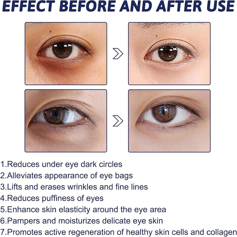 Under Eye Lifting Cream Firming Line Smoothing Dark Circles Puffy Eye Bags
