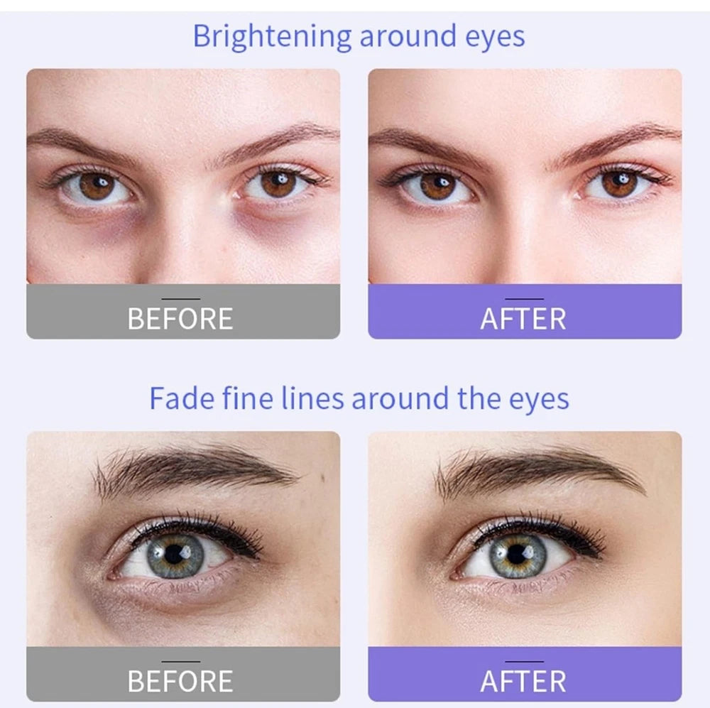 Eye Cream, Eye Cream for Dark Circles and Puffy Eyes, Hydrating and Firming