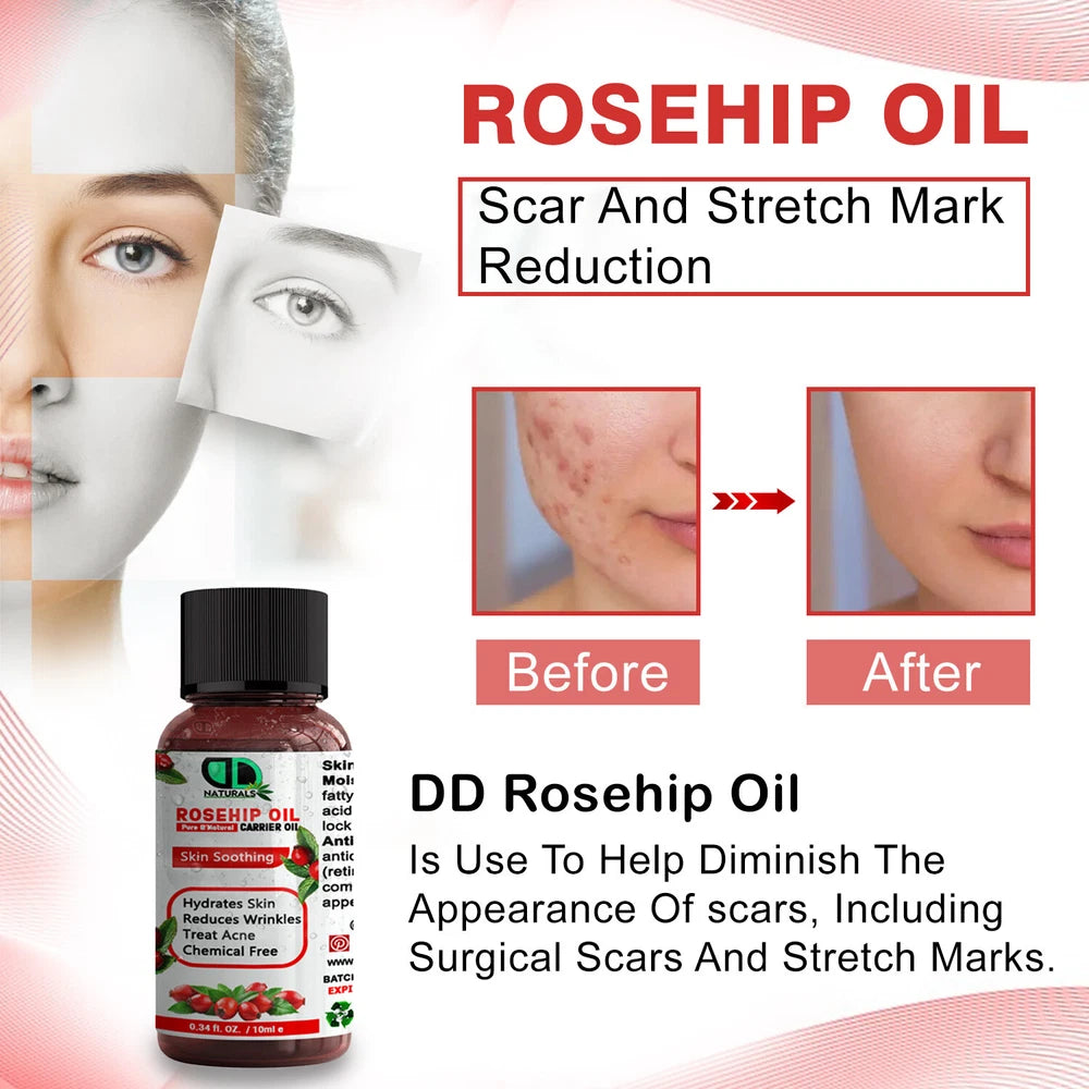 Rosehip Oil Certified Organic Skin Essential Oil Pure & Natural Best Facial Oil