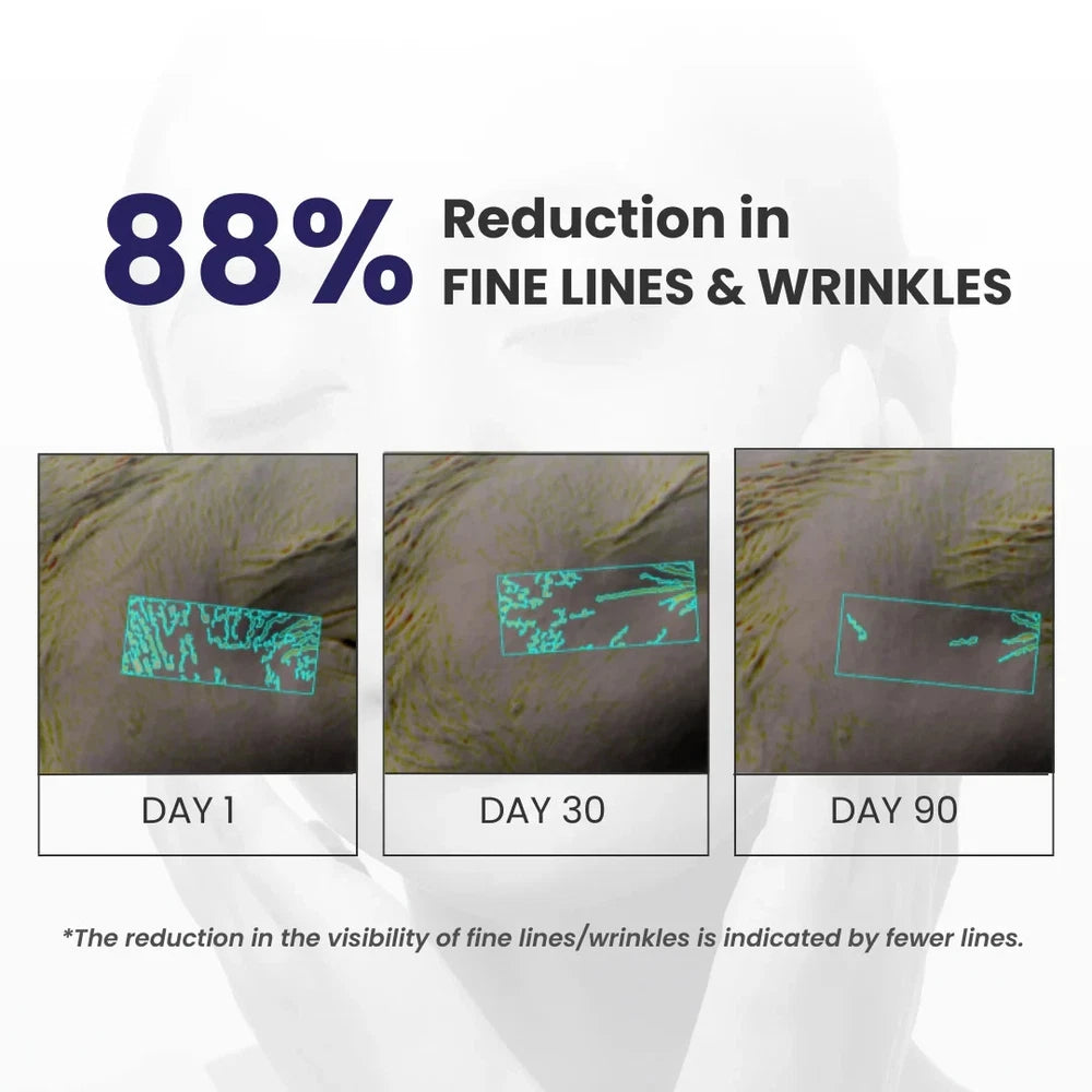 Retinol Face Cream Anti Ageing  | Wrinkle and Fine Line Repair | Night Cream