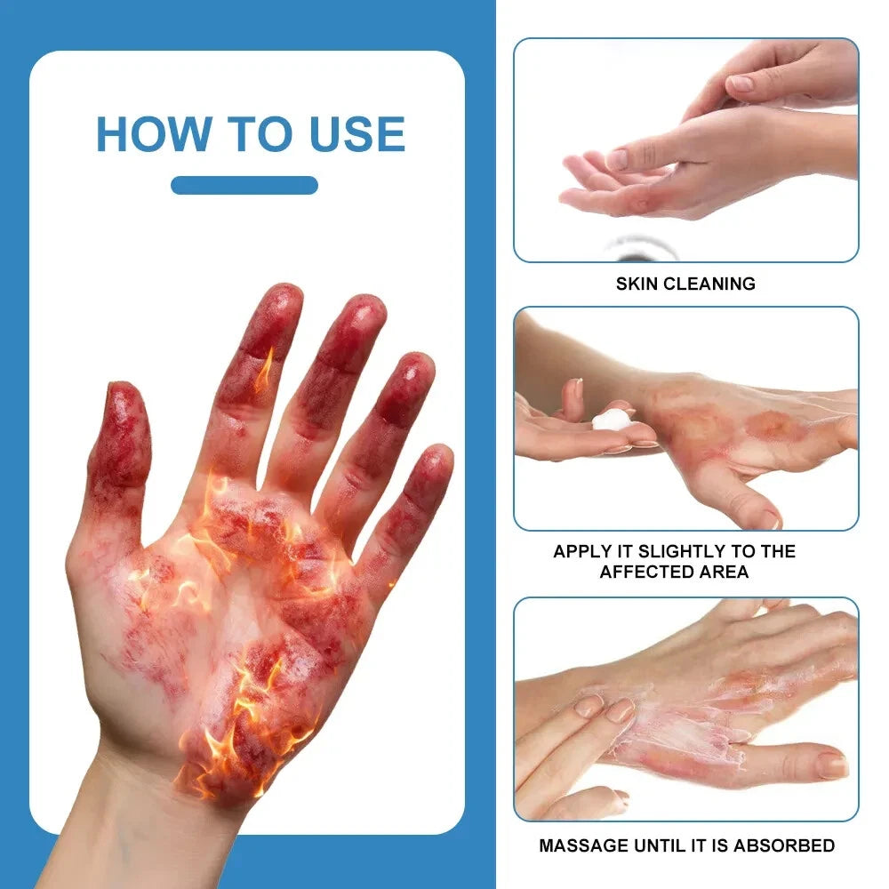 New 20g Wound Care Cream Dedicated to Damaged Skin Repair Infection Protection