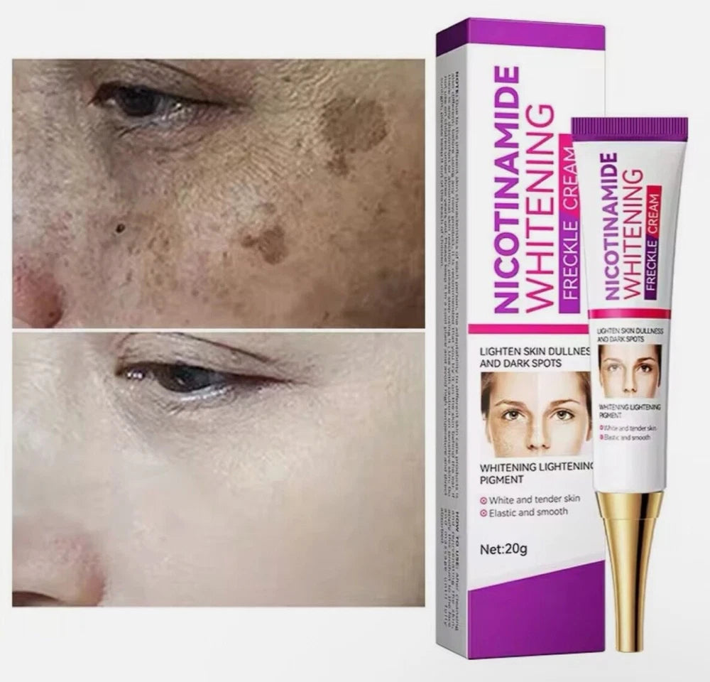 2pcs Dark Spot Niacinamide Lighting Melasma Cream Effectively Freckles Remover