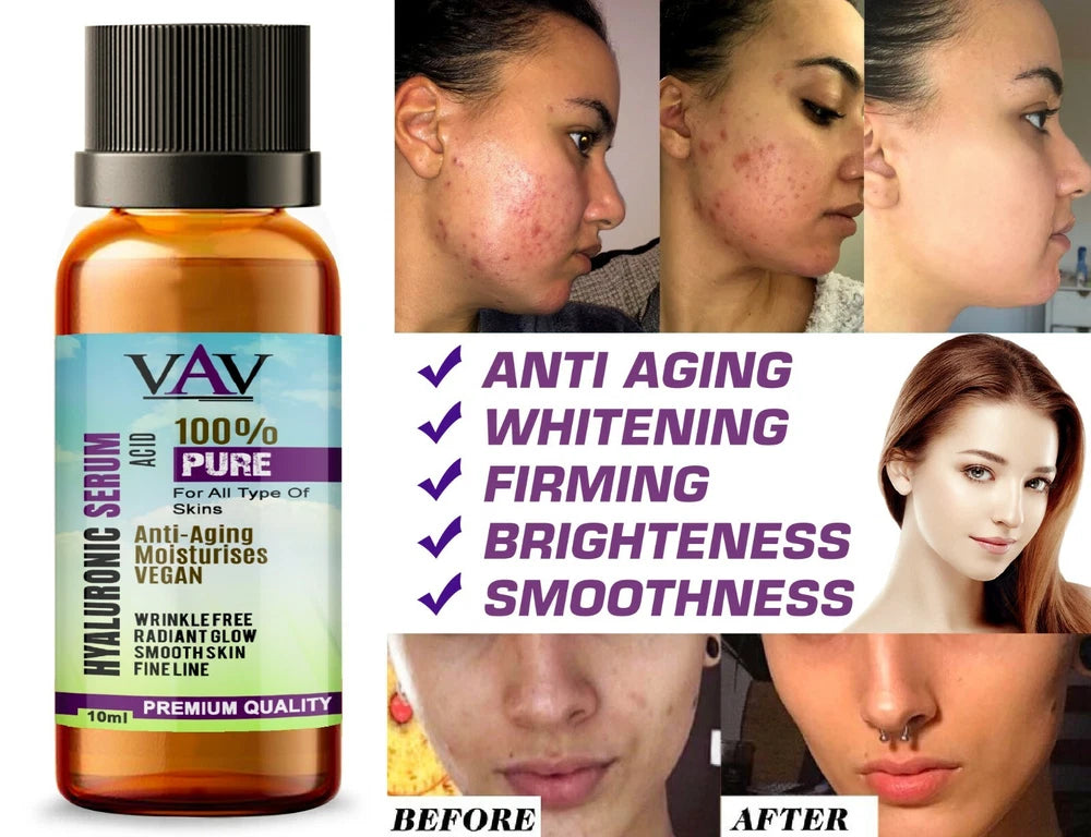 Strong Anti Wrinkle Serum HYALURONIC ACID Ageing Collagen for Derma Roller 10ml