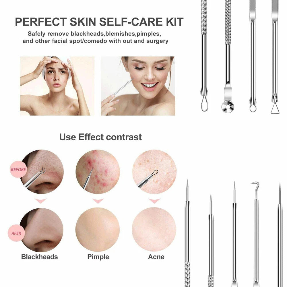 11x Blackhead Remover Tool Kit Spot Acne Pimple Comedone Extractor Comedone Box