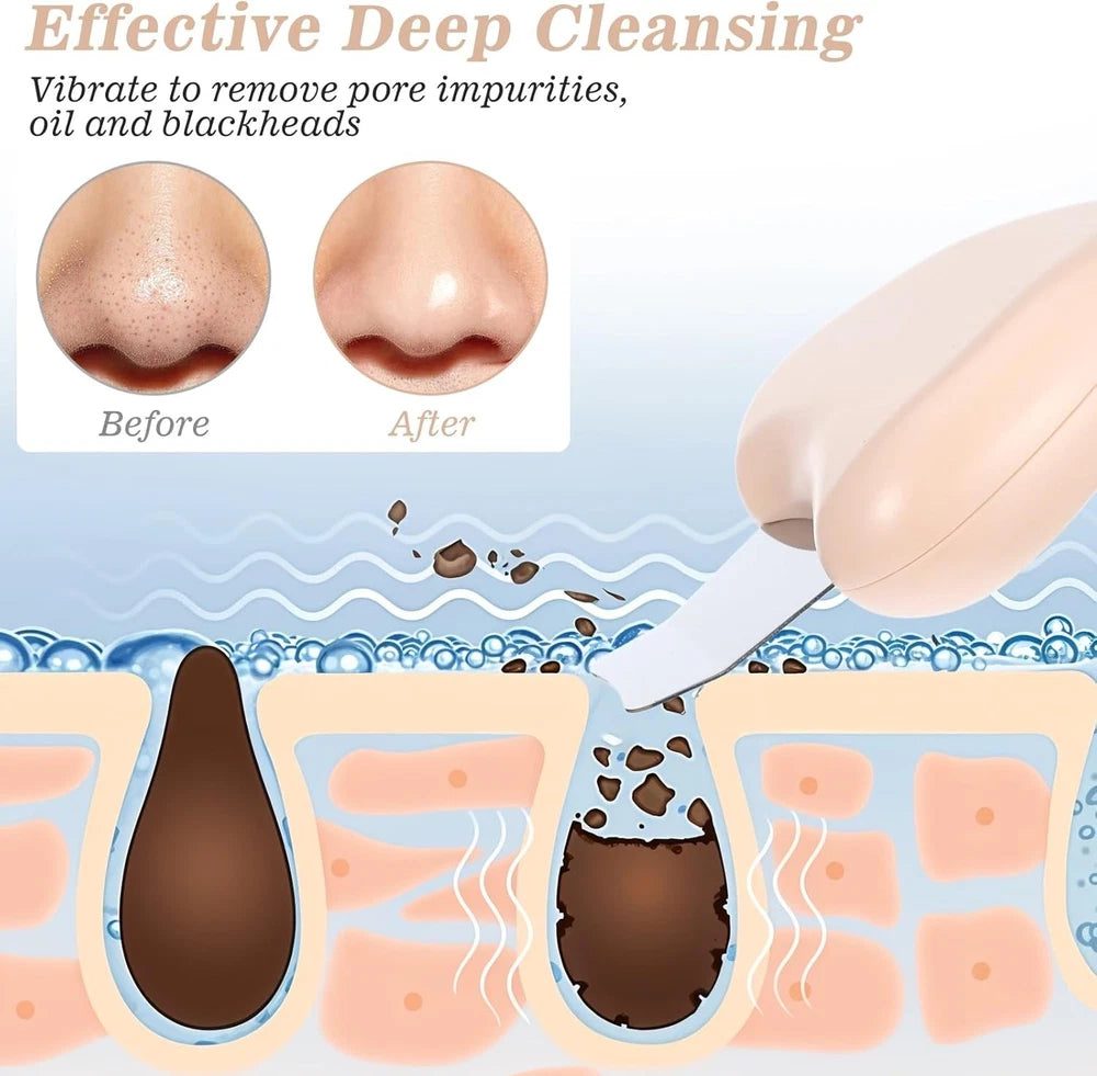 Skin Spatula Facial Cleaner Blackhead Removal Smooth Cleansing Scrubber Pores UK