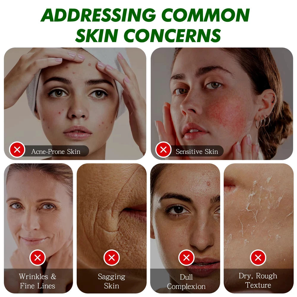 Snail Cream, Snail Mucin 92 Advance Cream, All-in-One Cream - 100ml