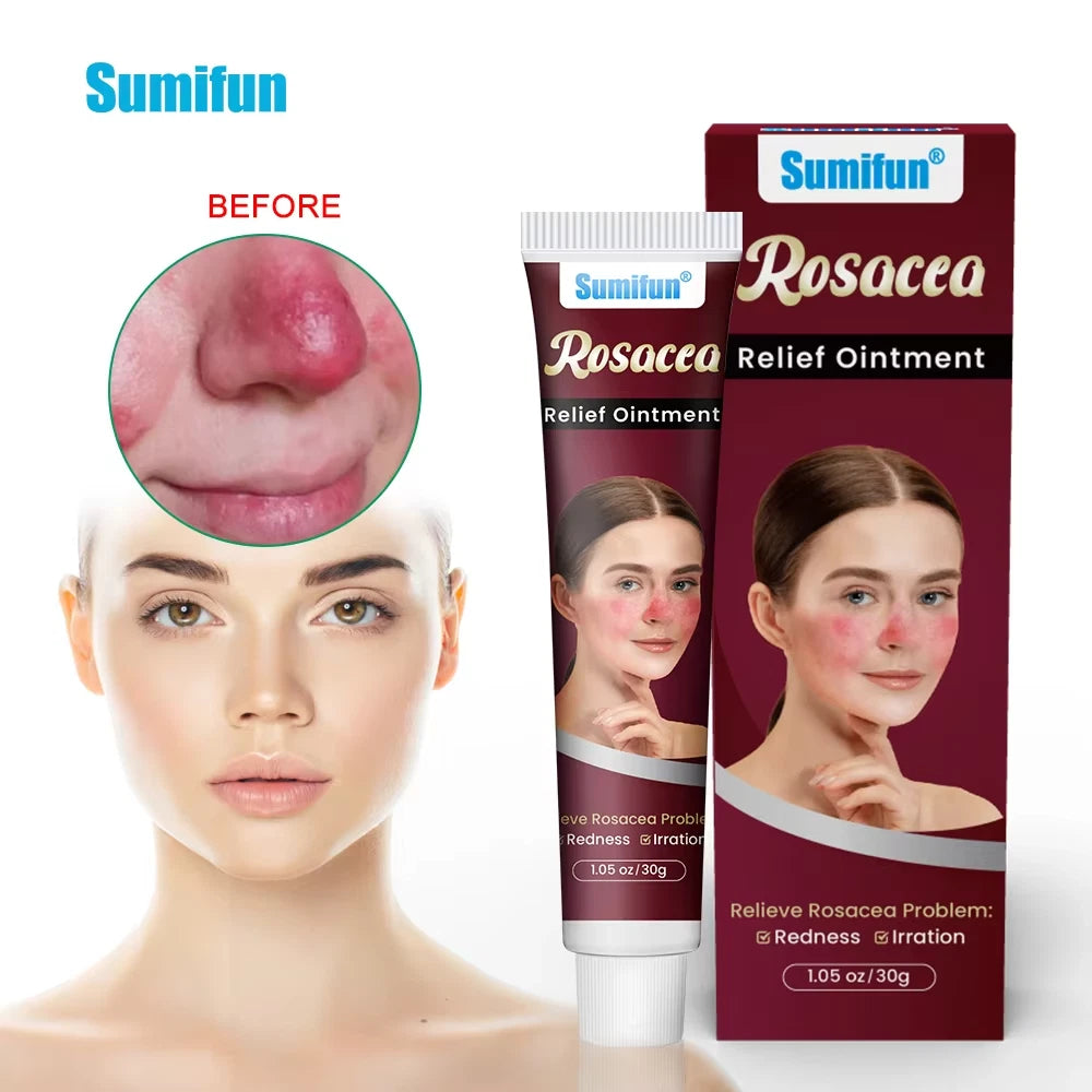New 30g Natural Herbal Red Face Skin Care Rosacca Cream Red Skin Relief Ointment