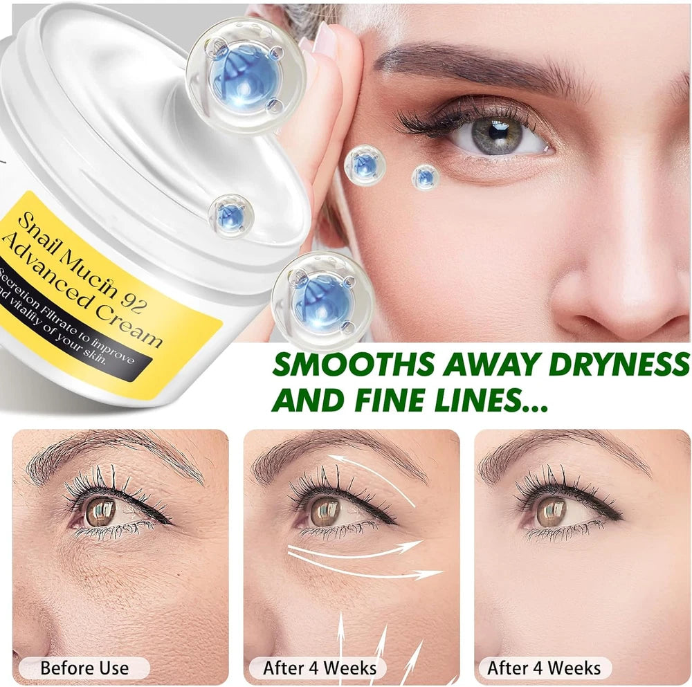 Snail Mucin 92% Face Moisturizer – 3.52 Oz Hydrating & Repairing Cream for Soft,