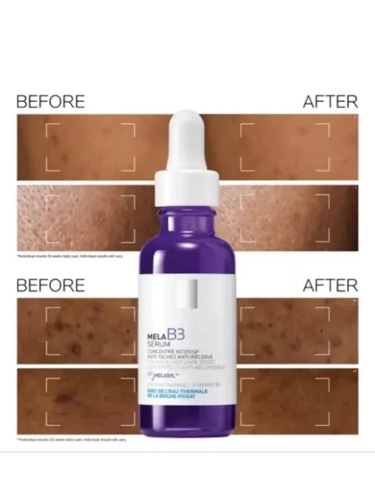 Unisex MELA B3 Anti-Dark Spot Serum for Hyperpigmentation 30ml