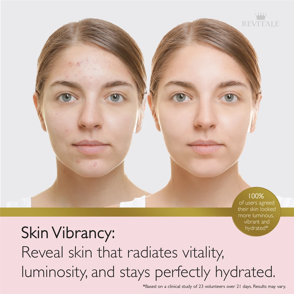 Revitale Advanced Salicylic Acid Cream 80g