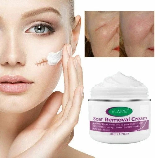 Scar Removal Cream New & Appearance of Old Scars Surgery, Stretch Marks, Acne,
