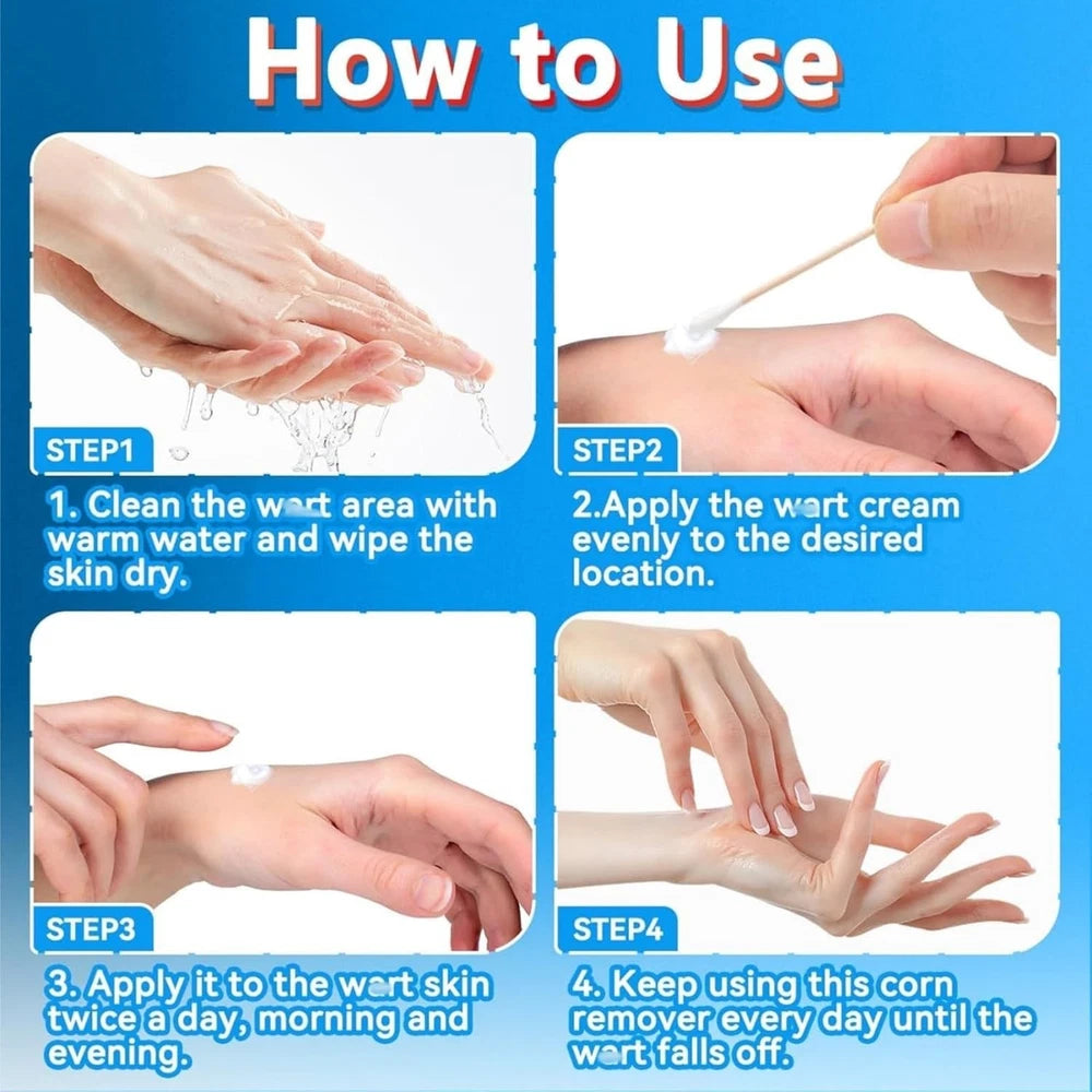 STRONG SKIN TAG REMOVER Cream NATURAL TREATMENT MOLES WARTS and TAGS