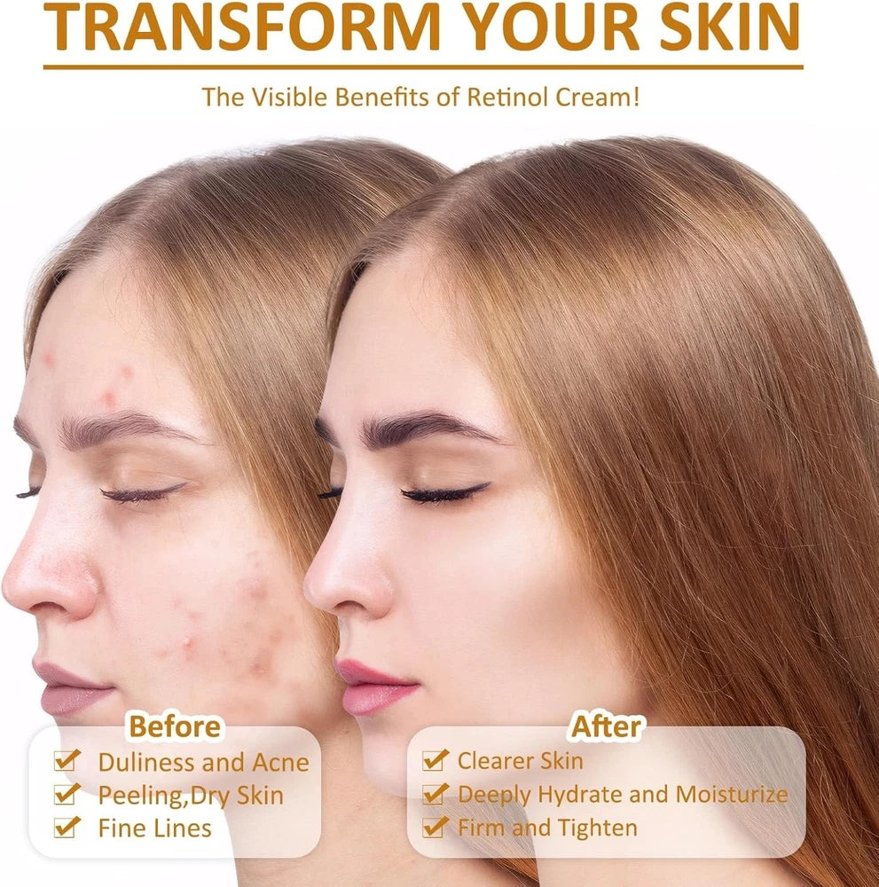 Beef Tallow for Skin, Beef Tallow and Honey Balm, Beef Tallow Face Moisturizer