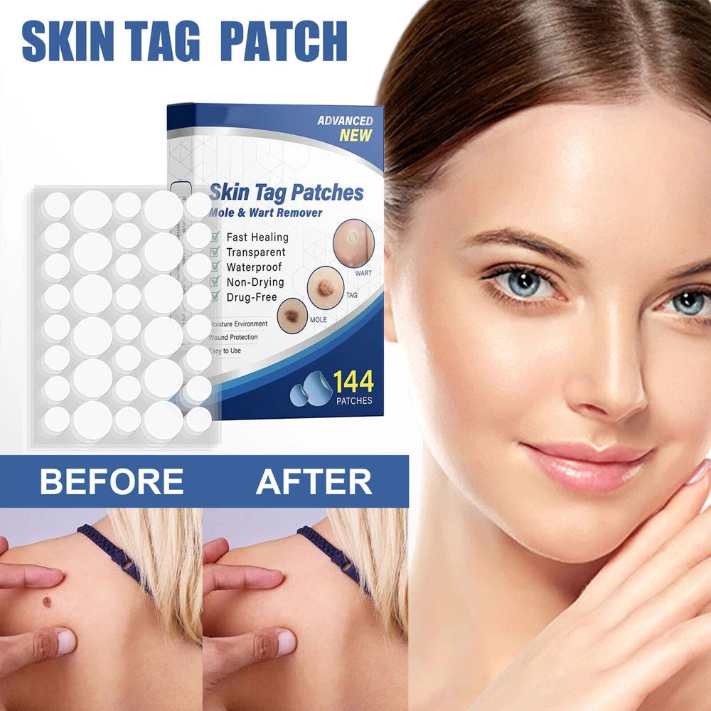 144pcs Skin Tag Remover Patches Quick Effective Mole Wart Removal Pad Sticker UK