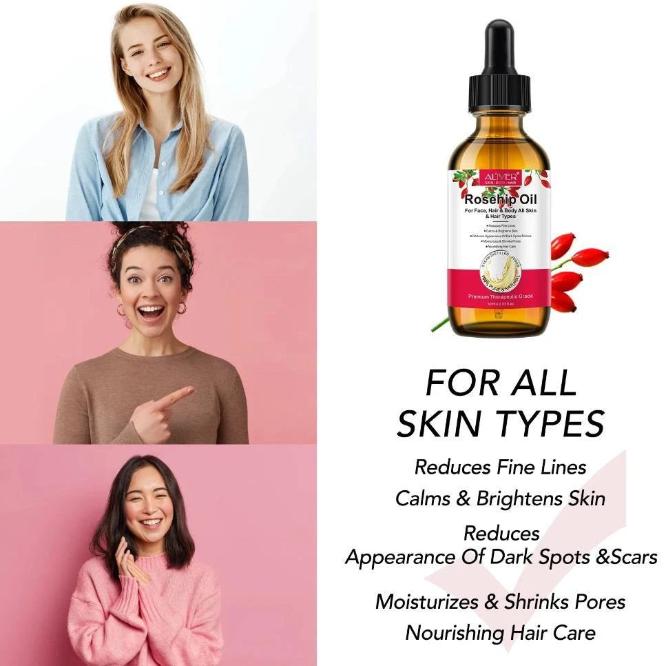 ROSEHIP Oil 100% PURE Natural BEST For Fine Lines Wrinkles Stretch Marks & Hair