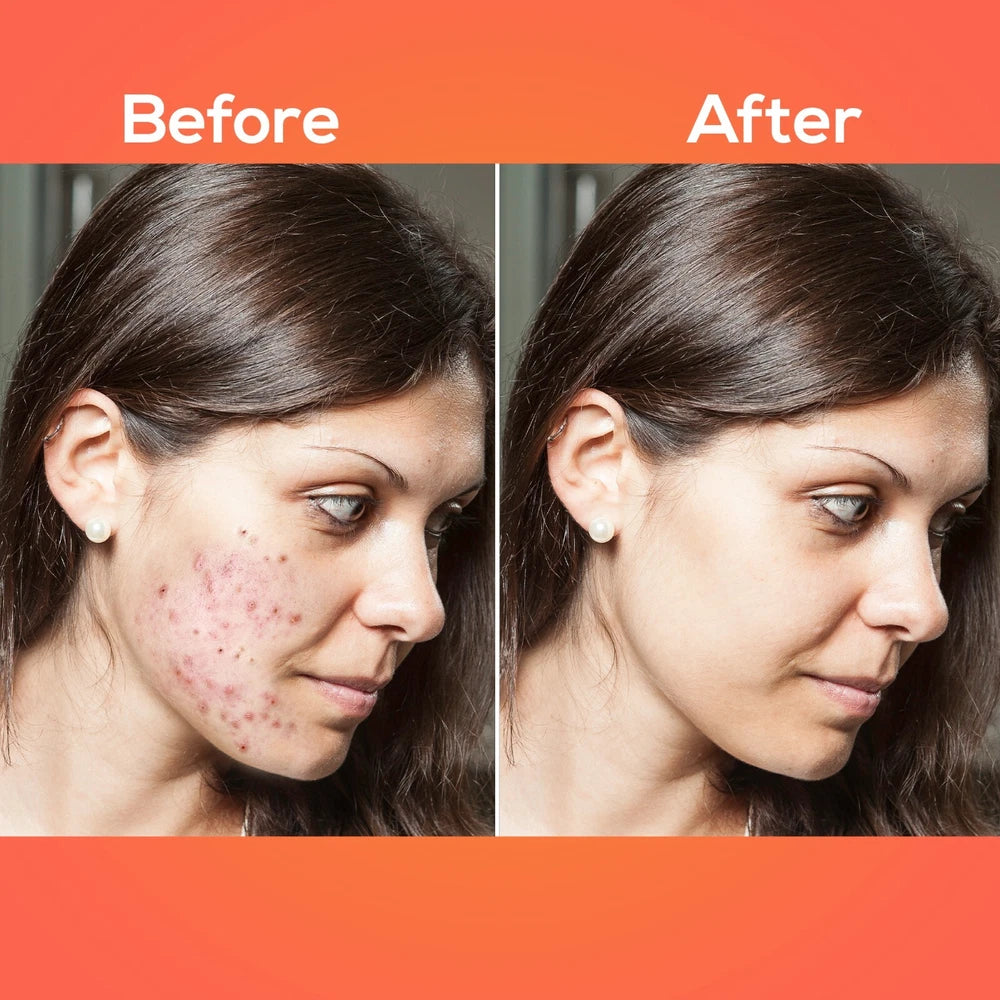 Vitamin C Serum For Face Anti-Aging Organic with Hyaluronic Acid Wrinkle Remover