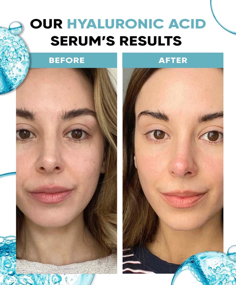 Hyaluronic Acid Serum 5% for Face with Vitamin B5 97.6% Natural Ingredients 30ml