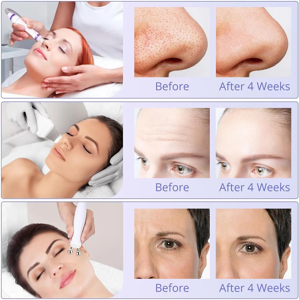 6 in1 Hydra Spa Water Facial Cleaner Aqua Peel Hydro Dermabrasion Beauty Machine