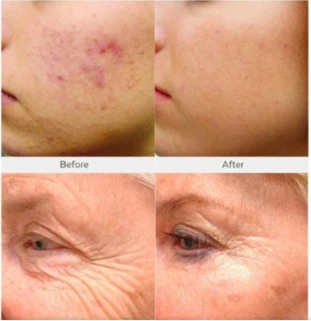 Retinol + Collagen, Hyaluronic Acid, Vitamin C AntiAging Wrinkle Serum Cream 4oz